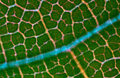 Bindweed epidermis, polarised light micrograph