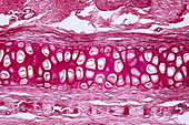 Human cartilage and bone, light micrograph