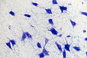 Nerve cells, light micrograph