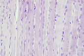 Skeletal muscle, light micrograph