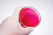 Escherichia coli bacteria on blood agar