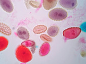 Pollen grains, light micrograph