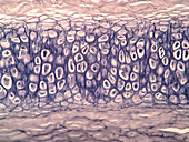 Human cartilage, light micrograph