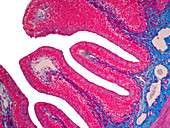 Human intestine tissue, light micrograph