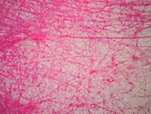 Human areolar tissue, light micrograph