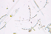 Marine plankton, light micrograph