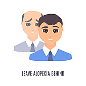 Male alopecia treatment, conceptual illustration