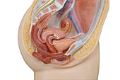 Female anatomical model