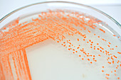 Colony of bacteria on culture medium