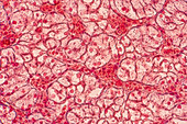 Squamous epithelial cells, light micrograph