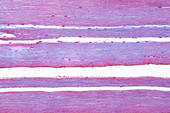 Human skeletal muscle, light micrograph