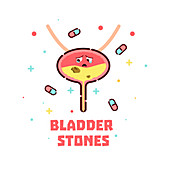 Bladder stone disease, conceptual illustration