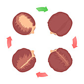 Hair loss stages in women, illustration