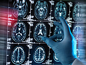 Neurology diagnosis, conceptual image