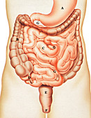 Intestinal strictures, illustration