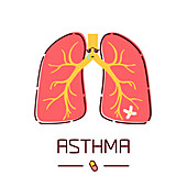 Asthma, conceptual illustration