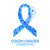 Colon cancer, conceptual illustration