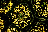 Daisy flower, light micrograph