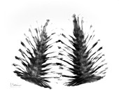Pine cones (Pinus sp.), X-ray