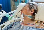 Woman on a ventilator in intensive care