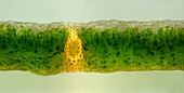 Maple leaf, light micrograph