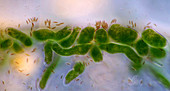 Ophrydium protozoa, light micrograph