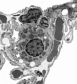 Alveolar cell, TEM