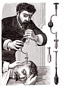 19th Century trepanning treatment, illustration