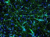Cortical neurons, fluorescence light micrograph