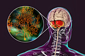 Human cerebellum and Purkinje neurons, illustration