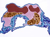 Lung capillary, TEM