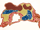 Lung capillary, TEM