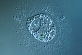 Nuclearia amoeba, light micrograph