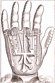 Prosthetic hand by surgeon Ambroise Pare, illustration