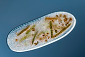 Frontonia protist, light micrograph