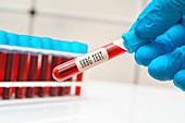 SHBG blood test, conceptual image
