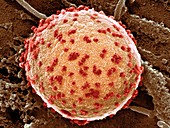 Cell infected by SARS-CoV-2 virus particles, SEM