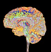 Human brain, 3D MRI scan