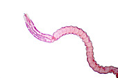 Tapeworm of cattle, light micrograph