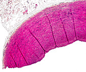 Human aorta section, light micrograph