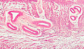 Cervical section, light micrograph