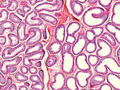 Epididymis section, light micrograph