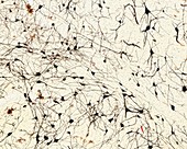 Neurons, light micrograph
