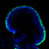 Human retinal organoid, fluorescent micrograph