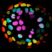 Colorectal cells, fluorescent light micrograph