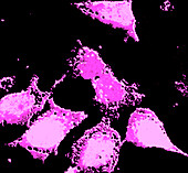 Neuroblast cells, fluorescent micrograph