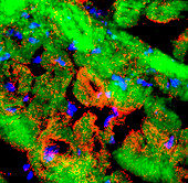 Heart muscle, fluorescence micrograph