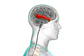 Brain with highlighted middle temporal gyrus, illustration