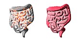 Healthy and unhealthy intestines, conceptual illustration