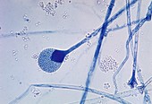 Mucor sp. fungus, light micrograph